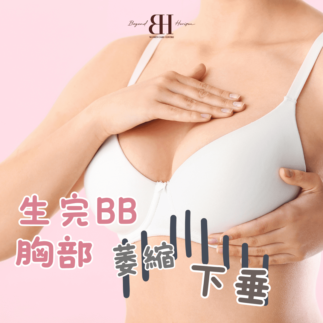 Read more about the article 生完BB 胸部萎縮又下垂？